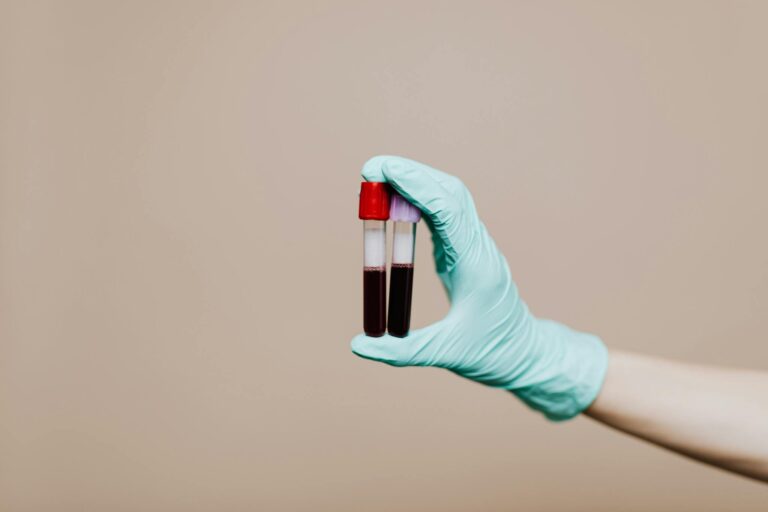 Close-up of a gloved hand holding two blood sample tubes in a laboratory setting.